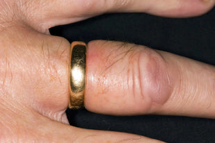 Stop Forcing Your Rings On